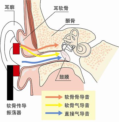 軟骨傳導(dǎo)的機理